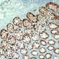 Anti-ALK5 Antibody